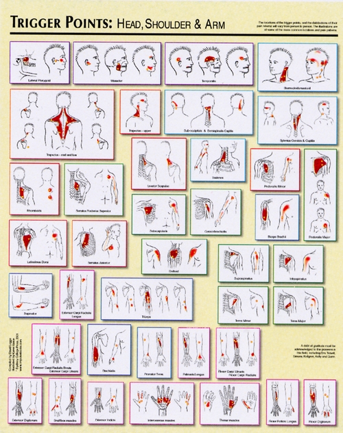 Trigger Points Chart (2) - Legge