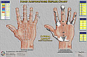 Hand Reflex Therapy Chart