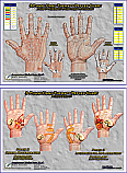 3-Phase Hand Reflex Therapy Charts