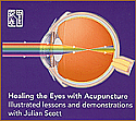 Healing the Eyes with Acupuncture DVD